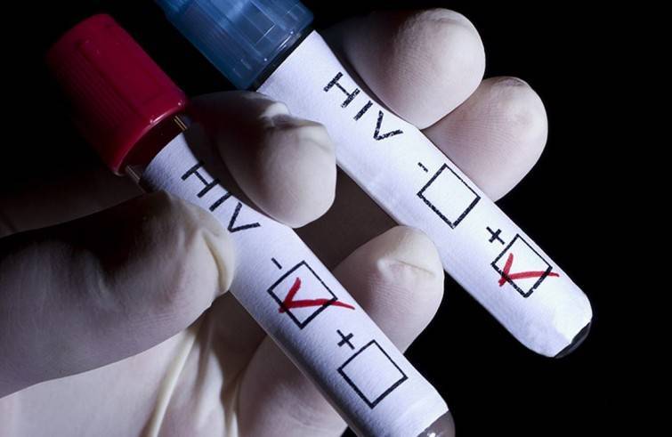 Hiv/Aids: meno male che ci sono le Chiese